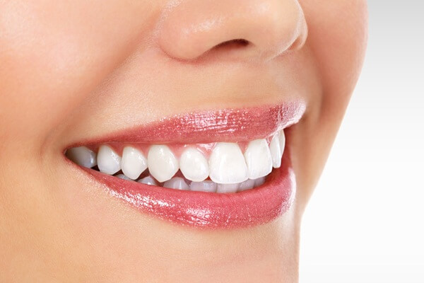 teeth-whitening-urban-dental-centre